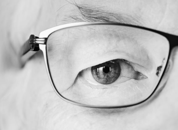 glaucoma-1 Ojo miope